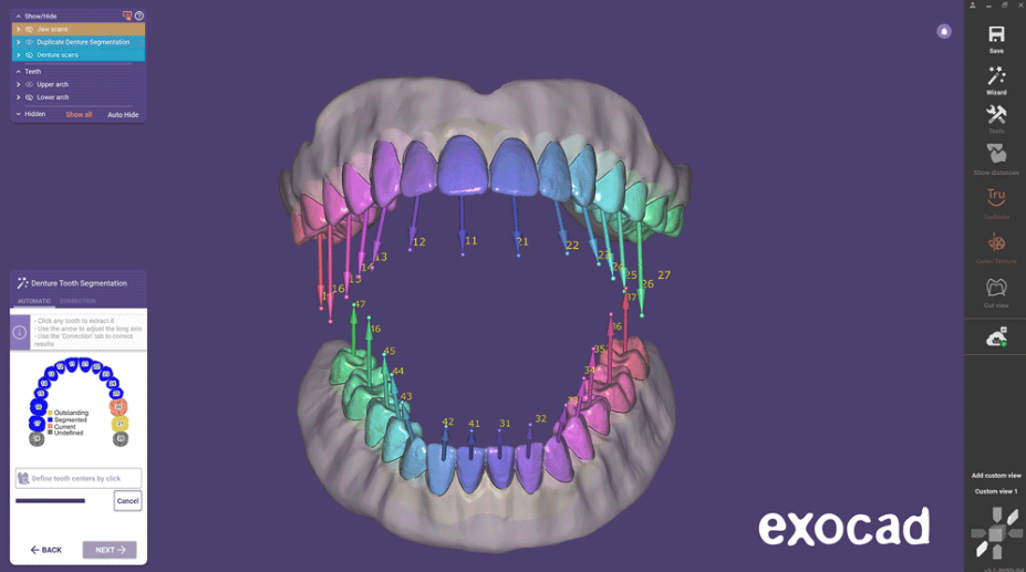 Full Denture Module Elefsina
